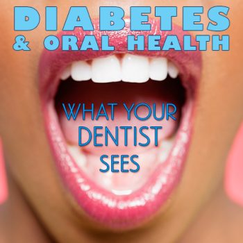 Sedalia dentist, Dr. Ehlers of Tiger Family Dental, discusses the side effects of diabetes and how it affects your oral health.