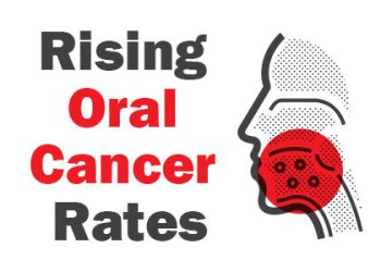 Sedalia dentist, Dr. Ehlers & Dr. Coleman of Tiger Family Dental talks about the process of screening for oral cancer as diagnosis rates are on the rise.
