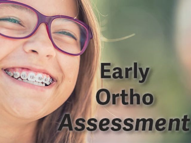 5 Reasons for Early Orthodontic Assessment (featured image)