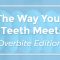 The Way Your Teeth Meet: Overbite Edition (featured image)