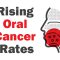 Rising Oral Cancer Rates – Have You Been Screened? (featured image)